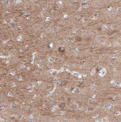 Immunohistochemistry-Paraffin: Ryanodine Receptor 2 Antibody [NBP1-90091]