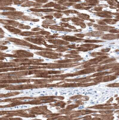 Immunohistochemistry-Paraffin: Ryanodine Receptor 2 Antibody [NBP1-90091]
