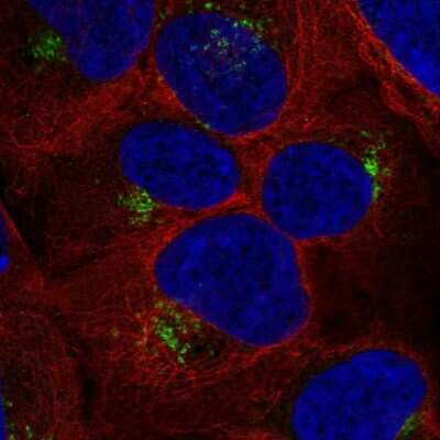 Immunocytochemistry/ Immunofluorescence: Ryk Antibody [NBP2-69008]