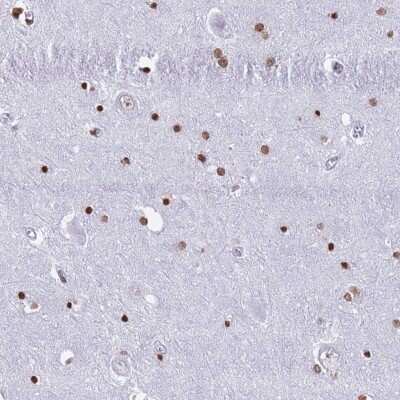 Immunohistochemistry: Ryk Antibody [NBP2-37915]