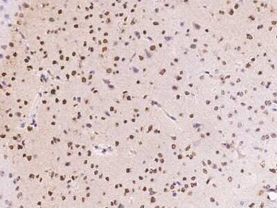 Immunohistochemistry-Paraffin: Ryk Antibody [NBP2-99540]