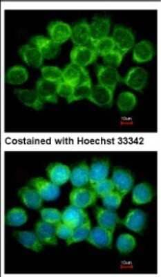 Immunocytochemistry/ Immunofluorescence: Adenosylhomocysteinase/AHCY Antibody [NBP2-20246]