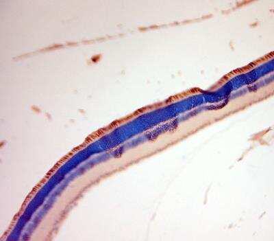Immunohistochemistry-Paraffin: S Opsin Antibody - Azide and BSA Free [NBP1-20194]