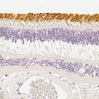 Immunohistochemistry-Paraffin: S Opsin Antibody [NBP2-55602]