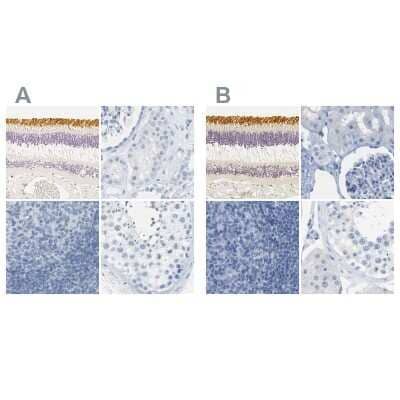 Immunohistochemistry-Paraffin: S Opsin Antibody [NBP2-55602]