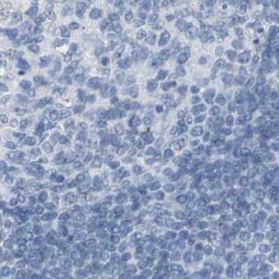 Immunohistochemistry-Paraffin: S Opsin Antibody [NBP2-55602]