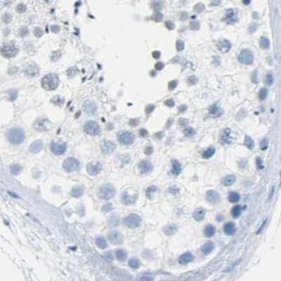 Immunohistochemistry-Paraffin: S Opsin Antibody [NBP2-55602]