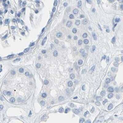 Immunohistochemistry-Paraffin: S Opsin Antibody [NBP2-55602]