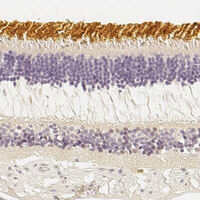 Immunohistochemistry-Paraffin: S Opsin Antibody [NBP2-58288]