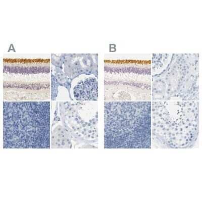 Immunohistochemistry-Paraffin: S Opsin Antibody [NBP2-58288]