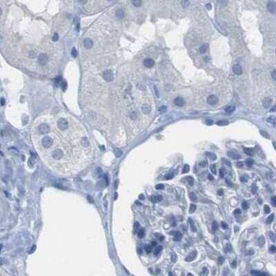 Immunohistochemistry-Paraffin: S Opsin Antibody [NBP2-58288]
