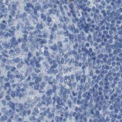 Immunohistochemistry-Paraffin: S Opsin Antibody [NBP2-58288]