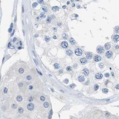 Immunohistochemistry-Paraffin: S Opsin Antibody [NBP2-58288]