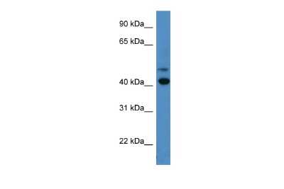 Western Blot: S Opsin Antibody [NBP2-88203]