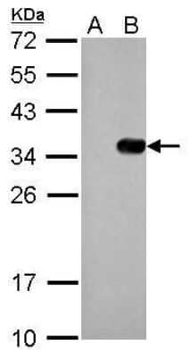 Western Blot: S-Tag Epitope Tag Antibody (247) [NBP2-43726]