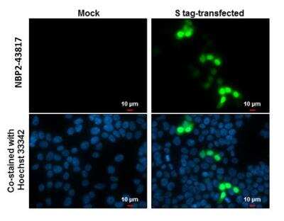 Immunocytochemistry/ Immunofluorescence: S-Tag Epitope Tag Antibody (727) [NBP2-43817]