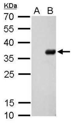 Western Blot: S-Tag Epitope Tag Antibody (727) [NBP2-43817]