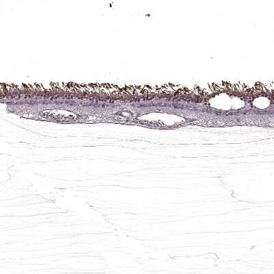Immunohistochemistry-Paraffin: S-arrestin Antibody [NBP2-55126]