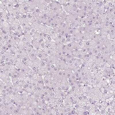 Immunohistochemistry-Paraffin: S-arrestin Antibody [NBP2-55126]