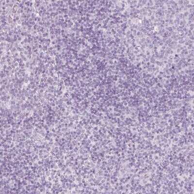 Immunohistochemistry-Paraffin: S-arrestin Antibody [NBP2-55126]