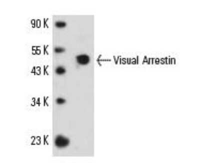 Western Blot: S-arrestin Antibody (PDS-1)Azide and BSA Free [NBP2-80937]