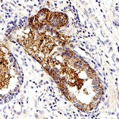 Immunohistochemistry-Paraffin: S-arrestin Antibody (PDS-1) - BSA Free [NB100-2385]