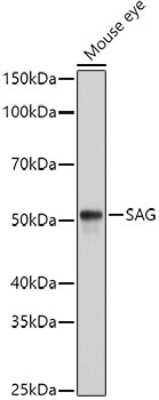 Western Blot: S-arrestin AntibodyAzide and BSA Free [NBP2-94241]