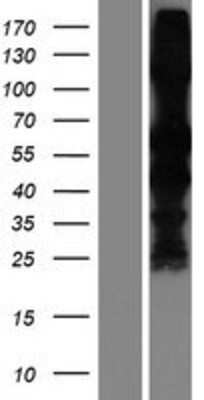 Western Blot: S-arrestin Overexpression Lysate [NBP2-10683]