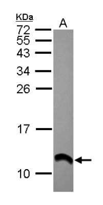 Western Blot: S100A2 Antibody [NBP2-20247]