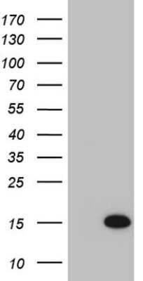 Western Blot: S100 calcium binding protein A14 Antibody (OTI2G9) [NBP2-45659]