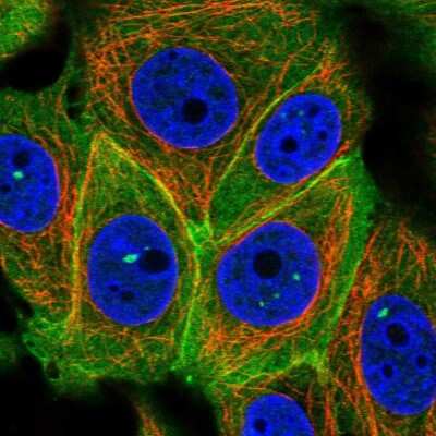 Immunocytochemistry/ Immunofluorescence: S100 calcium binding protein A14 Antibody [NBP1-90000]