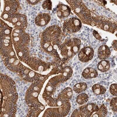 Immunohistochemistry-Paraffin: S100 calcium binding protein A14 Antibody [NBP1-90000]