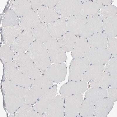 Immunohistochemistry-Paraffin: S100 calcium binding protein A14 Antibody [NBP1-90000]