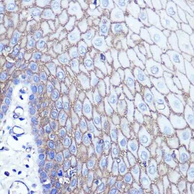 Immunohistochemistry-Paraffin: S100 calcium binding protein A14 Antibody - BSA Free [NBP2-93478]
