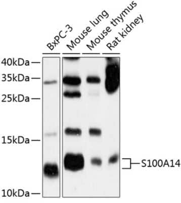 Western Blot: S100 calcium binding protein A14 AntibodyBSA Free [NBP2-93478]