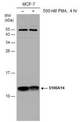 Western Blot: S100 calcium binding protein A14 Antibody [NBP3-12990]