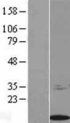 Western Blot: S100 calcium binding protein A14 Overexpression Lysate [NBL1-15652]