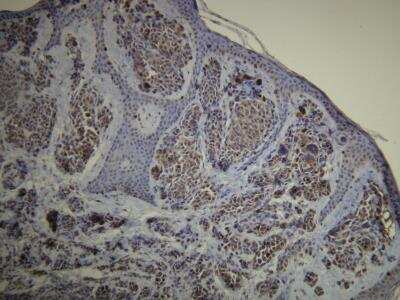 Immunohistochemistry-Paraffin: S100A1 Antibody (D28-E) [NBP1-30154]