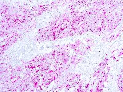 Immunohistological Staining of S100A/B in Paraffin Embedded Human Skin