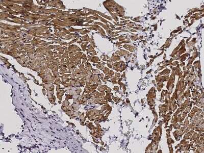 Immunohistochemistry-Paraffin: S100A1 Antibody (004) [NBP2-90503]