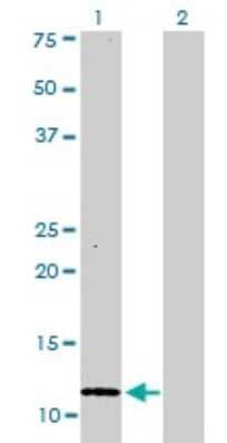 Western Blot: S100A1 Antibody (1D5) [H00006271-M01]