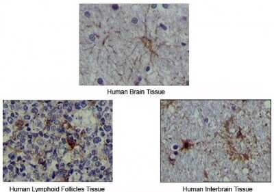 Immunohistochemistry-Paraffin: S100A1 Antibody (2C8B8) - BSA Free [NB110-60530]