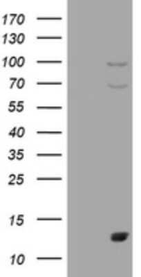 Western Blot: S100A1 Antibody (OTI6G4) [NBP2-45658]