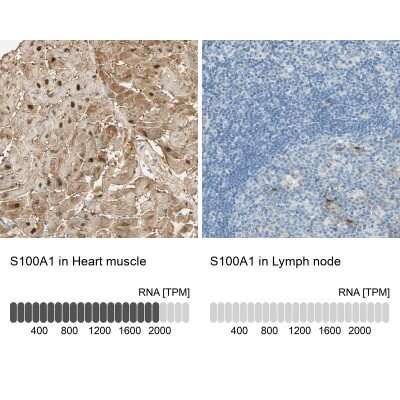 Immunohistochemistry-Paraffin: S100A1 Antibody [NBP1-87103]