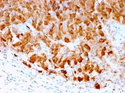 Immunohistochemistry-Paraffin: S100A1 Antibody (S100A1/1942) - Azide and BSA Free [NBP2-47924]