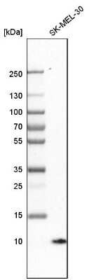 Western Blot: S100A1 Antibody [NBP1-87103]