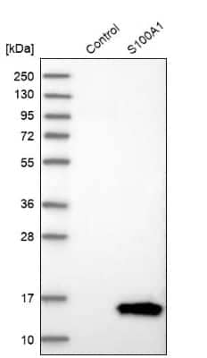 Western Blot: S100A1 Antibody [NBP1-87103]