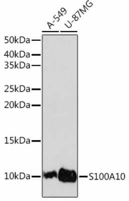 Western Blot: S100A10 Antibody (6X8F7) [NBP3-15467]