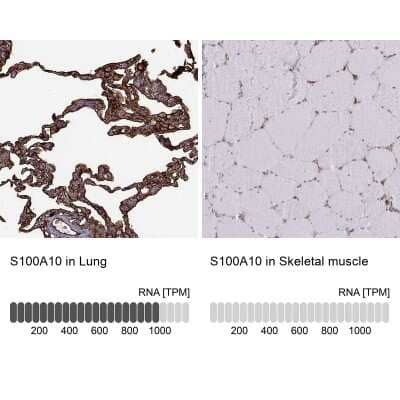 Immunohistochemistry-Paraffin: S100A10 Antibody [NBP1-89370]