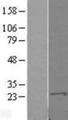 Western Blot: S100A10 Overexpression Lysate [NBL1-15648]